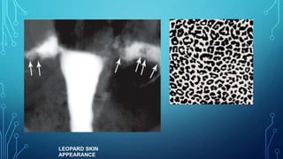 LEOPARD SKIN
APPEARANCE
 