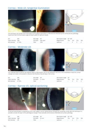 Haag-Streit Diagnostics Slit Lamp Imaging Guide | PDF