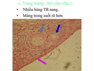 c. Nang trứng thứ cấp (đặc): 
• Nhiều hàng TB nang. 
• Màng trong suốt rõ hơn. 
 