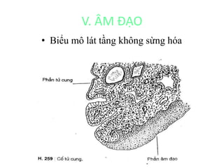 V. ÂM ĐẠO 
• Biểu mô lát tầng không sừng hóa 
 