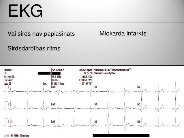 Sirds mazspeja - groupsnored