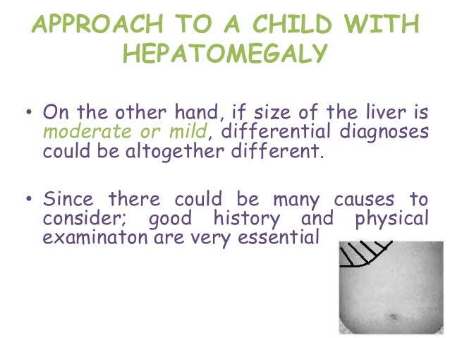 What are the causes of tender hepatomegaly?