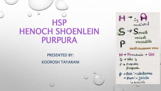 HSP
HENOCH SHOENLEIN
PURPURA
PRESENTED BY:
KOOROSH TAYARANI
 