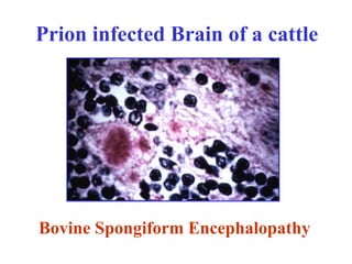 Prion infected Brain of a cattle
Bovine Spongiform Encephalopathy
 