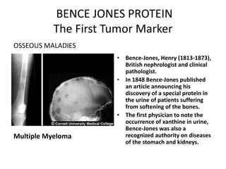  BENCE JONES PROTEINThe First Tumor MarkerOSSEOUS MALADIESMultiple MyelomaBence-Jones, Henry (1813-1873), British nephrologist and clinical pathologist. In 1848 Bence-Jones published an article announcing his discovery of a special protein in the urine of patients suffering from softening of the bones. The first physician to note the occurrence of xanthine in urine, Bence-Jones was also a recognized authority on diseases of the stomach and kidneys.