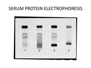 SERUM PROTEIN ELECTROPHORESIS