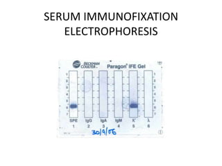 SERUM IMMUNOFIXATIONELECTROPHORESIS