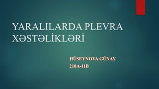YARALILARDA PLEVRA
XƏSTƏLİKLƏRİ
HÜSEYNOVA GÜNAY
218A-11B
 