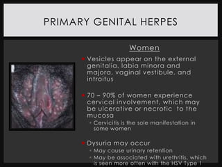PRIMARY GENITAL HERPES

                       Women
       Vesicles appear on the external
        genitalia, labia minora and
        majora, vaginal vestibule, and
        introitus

       70 – 90% of women experience
        cervical involvement, which may
        be ulcerative or necrotic to the
        mucosa
         Cervicitis is the sole manifestation in
          some women

       Dysuria may occur
         May cause urinary retention
         May be associated with urethritis, which
          is seen more often with the HSV Type 1
 