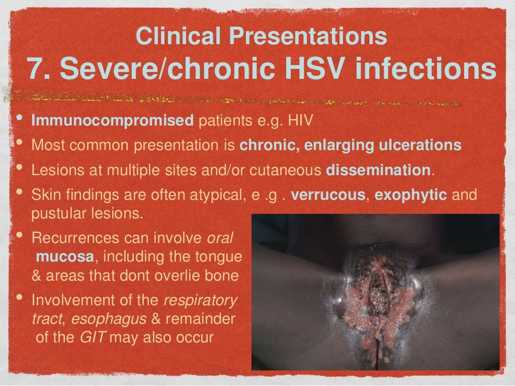Hsv 1 Pictures : Frontiers Herpes Simplex Virus Type 1 Infection Of The Central Nervous System ...