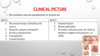 CLINICAL PICTURE 
• The condition may be asymptomatic or present by 
 