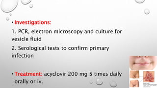 • Investigations: 
1. PCR, electron microscopy and culture for 
vesicle fluid 
2. Serological tests to confirm primary 
infection 
• Treatment: acyclovir 200 mg 5 times daily 
orally or iv. 
 