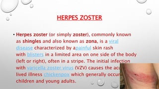 HERPES ZOSTER 
• Herpes zoster (or simply zoster), commonly known 
as shingles and also known as zona, is a viral 
disease characterized by apainful skin rash 
with blisters in a limited area on one side of the body 
(left or right), often in a stripe. The initial infection 
with varicella zoster virus (VZV) causes the acute, short-lived 
illness chickenpox which generally occurs in 
children and young adults. 
 
