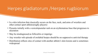 Hsv infections(cutaneous and genital) | PPTX