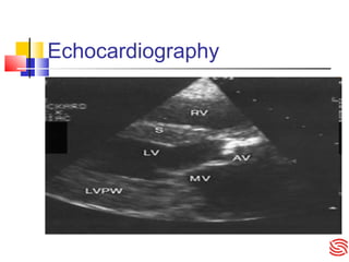 Echocardiography
 