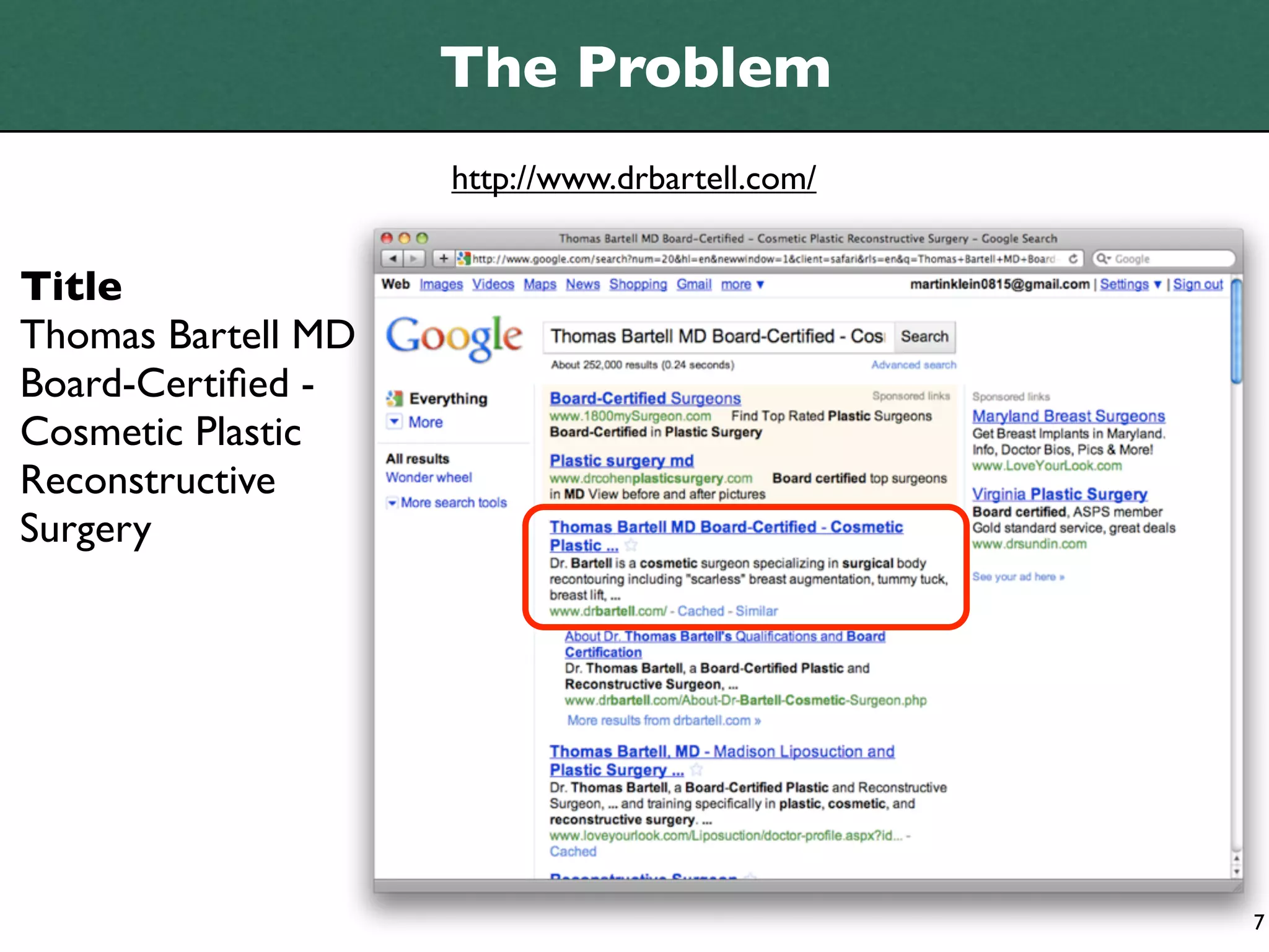 The Problem
                    http://www.drbartell.com/


Title
Thomas Bartell MD
Board-Certiﬁed -
Cosmetic Plastic
Reconstructive
Surgery




                                                7
 