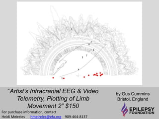 “Artist’s Intracranial 
EEG & Video 
Telemetry, Plotting of 
Limb Movement 2” 
$150 
by Gus Cummins 
Bristol, England 
Vector Graphics 
For purchase information, contact 
Heidi Meireles 
hmeireles@efa.org 909-464-8137 
 