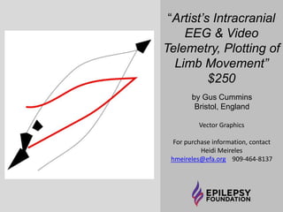 “Artist’s Intracranial EEG & Video 
Telemetry, Plotting of Limb 
Movement 2” $150 
by Gus Cummins 
Bristol, England 
For purchase information, contact 
Heidi Meireles hmeireles@efa.org 909-464-8137 
 