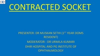 Contracted Socket Presentation Dhb Pptx