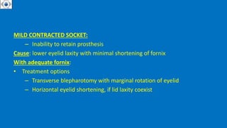 MILD CONTRACTED SOCKET:
– Inability to retain prosthesis
Cause: lower eyelid laxity with minimal shortening of fornix
With adequate fornix:
• Treatment options
– Transverse blepharotomy with marginal rotation of eyelid
– Horizontal eyelid shortening, if lid laxity coexist
 