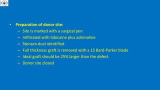 • Preparation of donor site:
– Site is marked with a surgical pen
– Infiltrated with lidocaine plus adrenaline
– Stensen duct identified
– Full thickness graft is removed with a 15 Bard-Parker blade
– Ideal graft should be 25% larger than the defect
– Donor site closed
 