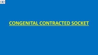 CONGENITAL CONTRACTED SOCKET
 