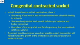 Congenital contracted socket
• In both Anophthalmos and Microphthalmos, there is
– Shortening of the vertical and horizontal dimensions of eyelids leading
to phimosis
– Shortened conjunctival fornices with deficiency of palpebral and
bulbar conjunctiva
– Hypoplasia of the bony orbit, and facial asymmetry due to reduction in
soft tissue volume
• Treatment should commence as early as possible as early intervention will
help stimulate the growth of the orbital bones and the periocular and
midfacial tissues
 