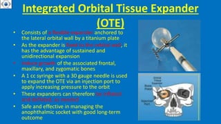 Integrated Orbital Tissue Expander
(OTE)
• Consists of a flexible expander anchored to
the lateral orbital wall by a titanium plate
• As the expander is fixed to the orbital wall, it
has the advantage of sustained and
unidirectional expansion
• Induce growth of the associated frontal,
maxillary, and zygomatic bones
• A 1 cc syringe with a 30 gauge needle is used
to expand the OTE via an injection port to
apply increasing pressure to the orbit
• These expanders can therefore be inflated
and deflated, as needed
• Safe and effective in managing the
anophthalmic socket with good long-term
outcome
 