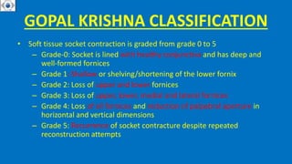 GOPAL KRISHNA CLASSIFICATION
• Soft tissue socket contraction is graded from grade 0 to 5
– Grade-0: Socket is lined with healthy conjunctiva and has deep and
well-formed fornices
– Grade 1: Shallow or shelving/shortening of the lower fornix
– Grade 2: Loss of upper and lower fornices
– Grade 3: Loss of upper, lower, medial and lateral fornices
– Grade 4: Loss of all fornices and reduction of palpebral aperture in
horizontal and vertical dimensions
– Grade 5: Recurrence of socket contracture despite repeated
reconstruction attempts
 