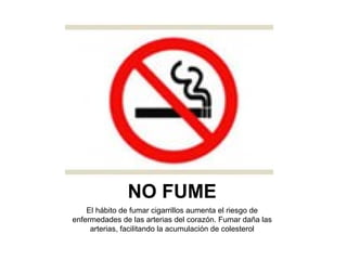 NO FUME El hábito de fumar cigarrillos aumenta el riesgo de enfermedades de las arterias del corazón. Fumar daña las arterias, facilitando la acumulación de colesterol 