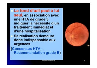  Le

fond d'œil peut à lui
seul, en association avec

une HTA de grade 3
indiquer la nécessité d'un
traitement immédiat et
d'une hospitalisation.
 Sa réalisation demeure
donc indispensable aux
urgences
(Consensus HTARecommandation grade B)
)
http://www.efurgences.net

14

 