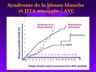 Temps écoulé avant la survenue d’un AVC (années)
0 1 2 3 1615141312114 105 6 7 8 9
Risquecumulatifd’AVC(%)
0
1
2
3
4
5
6
7
8
Syndrome de la
blouse blanche
p = 0,0013
Normotension
Hypertension
ambulatoire
Syndrome de la blouse blanche
et HTA masquée / AVC
Temps écoulé avant la survenue d’un AVC (années)
0 1 2 3 4 5 6 7 8 9 10 11 12 13 14 15 16
 