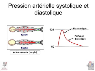 Pression artérielle systolique et
diastolique
Pic systolique
Perfusion
diastolique
Artère normale (souple)
120
80
 