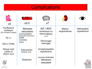 x2-3 x7x4
Complications
AIT / AVC
ischémique ou
hémorragique
+++
Hémorragie
méningée
Encéphalopathie
hypertensive
Lacunes cérébrales,
Démence
vasculaire
Insuffisance
cardiaque
(FE normale ou basse)
FA ++
ESV ± TVNS
Risque mort
subite x3
DCCV x3-5
Sténoses
vasculaires:
-Coronaropathie
Cardiopathie ischémique
-AOMI
-Carotides
-Autre
Anévrysmes:
Cérébral, aorte…
Néphro-
angiosclérose
Rétinopathie
hypertensive
Dissection
 