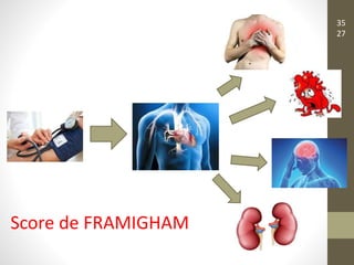 Score de FRAMIGHAM
35
27
 