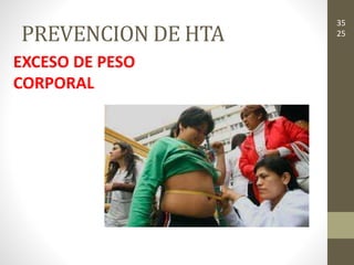 PREVENCION DE HTA
EXCESO DE PESO
CORPORAL
35
25
 