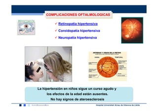 COMPLICACIONES OFTALMOLOGICAS
     COMPLICACIONES OFTALMOLOGICAS

            Retinopatía hipertensiva

            Coroidopatía hipertensiva

            Neuropatía hipertensiva




La hipertensión en niños sigue un curso agudo y
     los efectos de la edad están ausentes.
       No hay signos de ateroesclerosis
                                   Hospital Universitari Arnau de Vilanova de Lleida
 