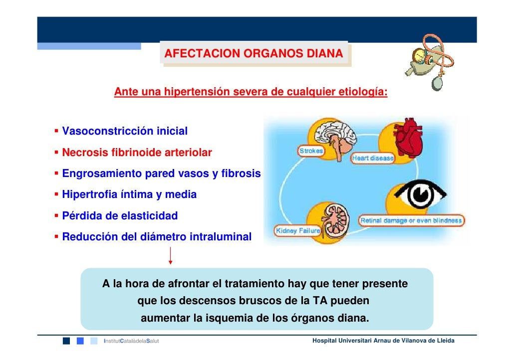 HTA pediatria HTA pediatria