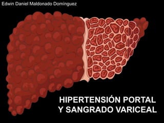 HIPERTENSION PORTAL ( HEMORRAGIA VARICEAL)
HIPERTENSIÓN PORTAL
Y SANGRADO VARICEAL
Edwin Daniel Maldonado Domínguez
 