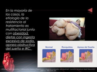 En la mayoría de
los casos, la
etiología de la
resistencia al
tratamiento es
multifactorial junto
con obesidad,
dietas con ingesta
excesiva de sodio,
apnea obstructiva
del sueño e IRC.
American Heart Association. Calhoun et al. Resistant Hypertension: Diagnosis, evaluation and treatment. Journal of American Heart Association.
2008: 51; 1403-1419. USA.
 