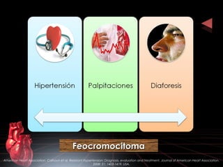 American Heart Association. Calhoun et al. Resistant Hypertension: Diagnosis, evaluation and treatment. Journal of American Heart Association.
2008: 51; 1403-1419. USA.
FeocromocitomaFeocromocitoma
 