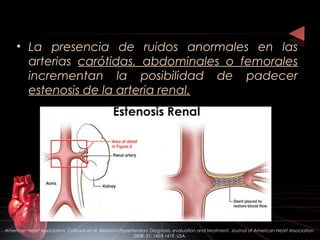 • La presencia de ruidos anormales en las
arterias carótidas, abdominales o femorales
incrementan la posibilidad de padecer
estenosis de la arteria renal.
American Heart Association. Calhoun et al. Resistant Hypertension: Diagnosis, evaluation and treatment. Journal of American Heart Association.
2008: 51; 1403-1419. USA.
 