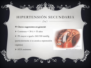 H I P E RT E N S I Ó N S E C U N DA R I A

 Claves sugerentes en general:

 Comienzo < 30 ó > 55 años

 PA mayor o igual a 160/100 mmHg

(particularmente si se asocia a repercusión
orgánica)

 HTA resistente.
 