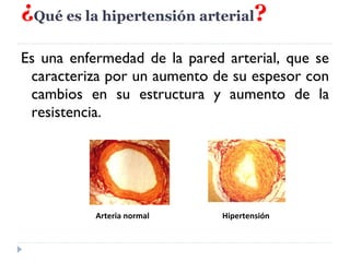 ¿ Qué es la hipertensión arterial ? Es una enfermedad de la pared arterial, que se caracteriza por un aumento de su espesor con cambios en su estructura y aumento de la resistencia. Arteria normal Hipertensión 