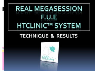 REAL MEGASESSION F.U.E                   HTCLINIC™ SYSTEM TECHNIQUE  &  RESULTS 