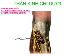 THẦN KINH CHI DƯỚI
1- THẦN KINH NGỒI:
1.4- VÙNG CẲNG CHÂN TRƯỚC:
B- THẦN KINH MÁC CHUNG:
 