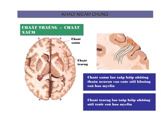 KHAÙI NIEÄM CHUNG
             KHAÙI NIEÄM CHUNG

CHAÁT TRAÉNG - CHAÁT
XAÙM
                 Chaát
                 xaùm




                    Chaát
                    traéng



                         Chaát xaùm laø taäp hôïp nhöõng
                         thaân neuron vaø caùc sôïi khoâng
                         coù bao myelin


                         Chaát traéng laø taäp hôïp nhöõng
                         sôïi truïc coù bao myelin
 