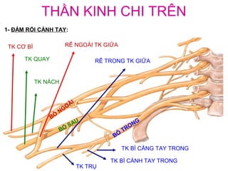 THẦN KINH CHI TRÊN
1- ĐÁM RỐI CÁNH TAY:


 TK CƠ BÌ              RỄ NGOÀI TK GIỮA

      TK QUAY                     RỄ TRONG TK GIỮA


            TK NÁCH


                        ÀI
                     NGO
                BÓ
                           U                       NG
                         SA                      O
                      BÓ                    TR
                                       BÓ

                                            TK BÌ CẲNG TAY TRONG

                                      TK BÌ CÁNH TAY TRONG
                             TK TRỤ
 