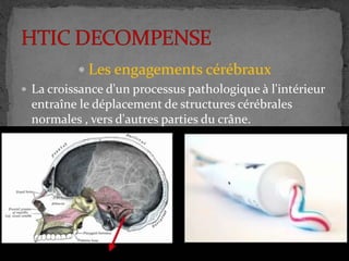  Les engagements cérébraux
 La croissance d'un processus pathologique à l'intérieur
entraîne le déplacement de structures cérébrales
normales , vers d'autres parties du crâne.
 Selon la localisation du processus expansif, plusieurs
types d'engagement cérébral existent
 