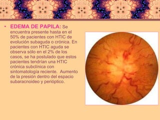 EDEMA DE PAPILA:  Se encuentra presente hasta en el 50% de pacientes con HTIC de evolución subaguda o crónica. En pacientes con HTIC aguda se observa sólo en el 2% de los casos, se ha postulado que estos pacientes tendrían una HTIC crónica subclínica con sintomatología reciente.  A umento de la presión dentro del espacio subaracnoideo y perióptico. 